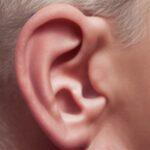 Chirurgia plastyczna uszu - Jak wygląda operacja korekcji uszu i ile kosztuje?